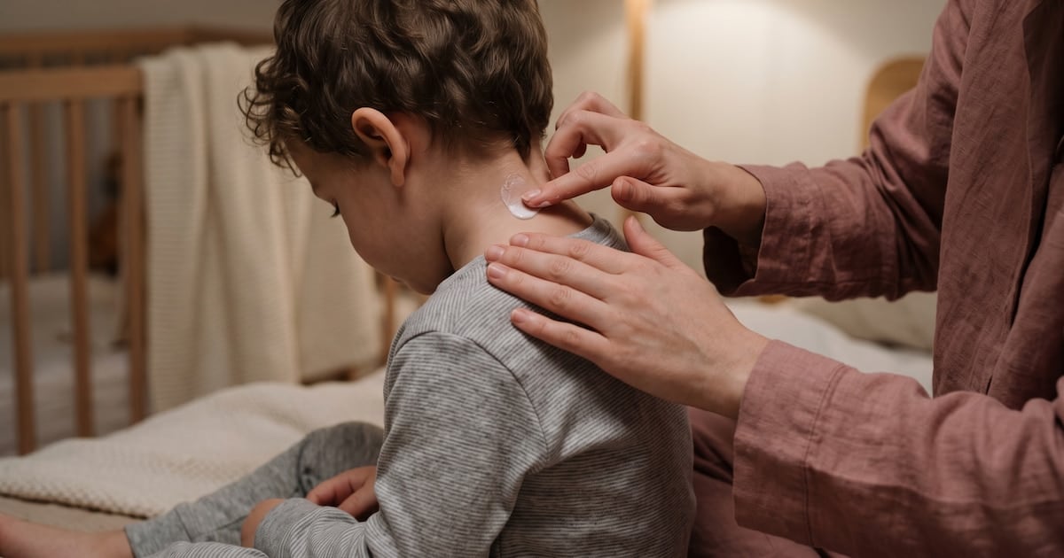 La dermatitis atópica no se toma vacaciones y los pacientes pagan los costos de un tratamiento que se vuelve una carrera de obstáculos
