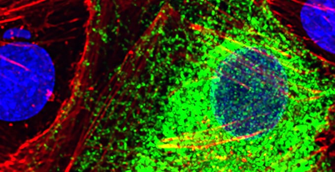 Una IA de Stanford aprendió a leer genes como quien lee los diarios: distingue células sanas de enfermas sin necesidad de haberlas visto antes